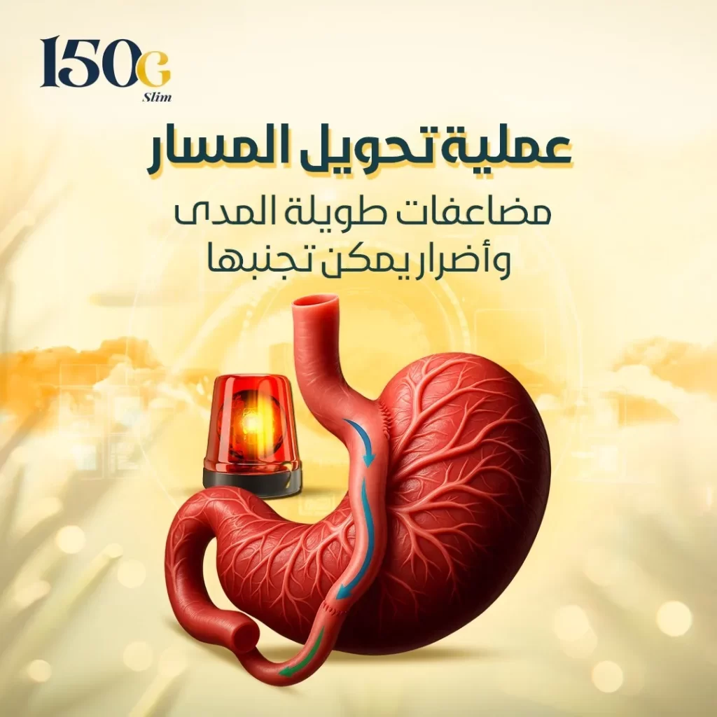 عملية تحويل مسار المعدة: مضاعفات طويلة المدى وأضرار يمكن تجنبها حبوب التنحيف التركية 150G Slim عملية تحويل مسار المعدة: مضاعفات طويلة المدى وأضرار يمكن تجنبها