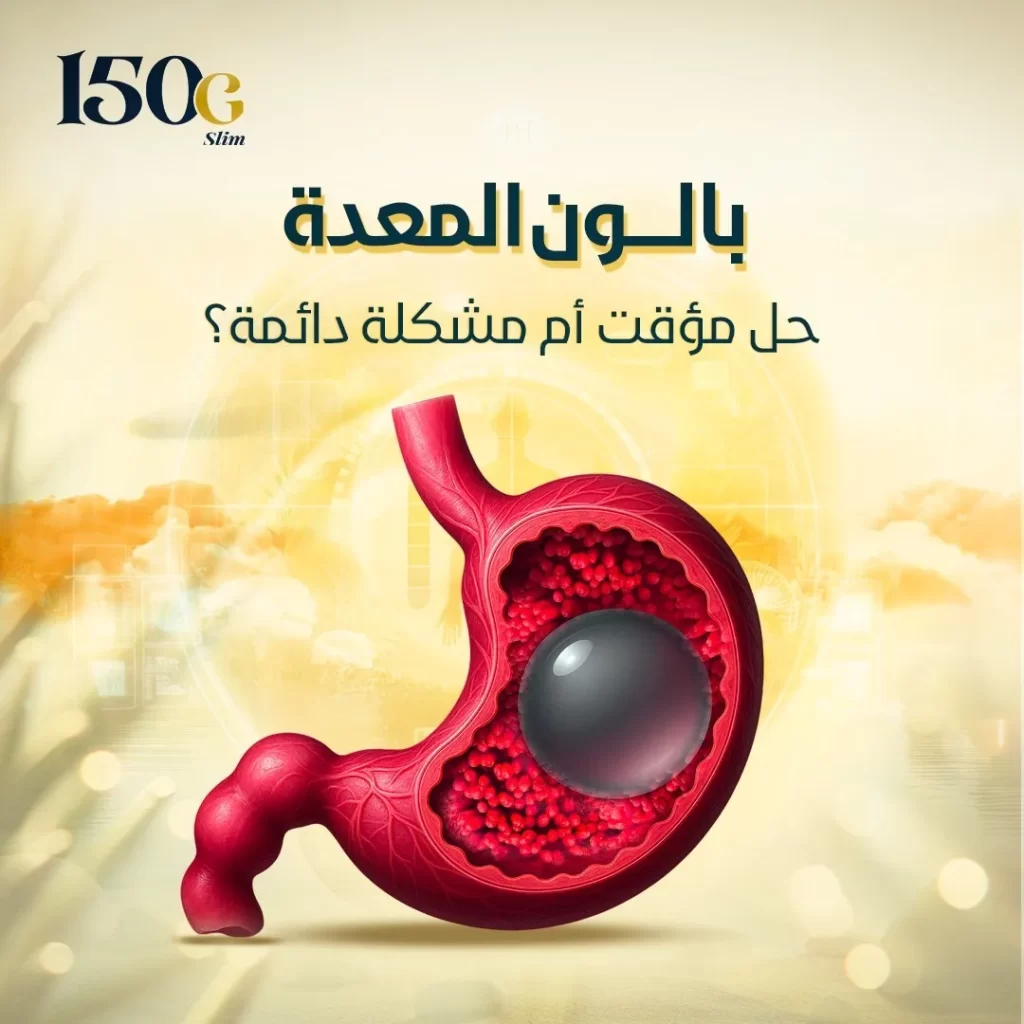 بالون المعدة: حل مؤقت أم مشكلة دائمة؟ حبوب التنحيف التركية 150G Slim بالون المعدة: حل مؤقت أم مشكلة دائمة؟